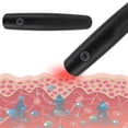 thumbnail image 2 of Bite Relief Pens, Gentle  Heat Vibration Deliver Itching Pen  For Office For Children, 2 of 8