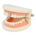 thumbnail image 3 of Ensemble de Capuchons pour Gril à Dents Simples, Couvercle Décoratif pour Gril Inférieur, Dents Supérieures en Strass pour Gril, 3 of 10
