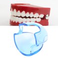 thumbnail image 1 of Mouth Opener Lip Cheek Retractor 5pcs Mouth Opener  Orthodontic Lip Cheek Retractor Expander  Mouth AccessoryTransparent Blue, 1 of 8