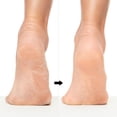 thumbnail image 2 of Revlon Callus Remover, Foot File with No-Mess Cover, Gently Exfoliates and Smooths Feet, 2 of 7