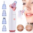 thumbnail image 1 of CYC Electric Blackhead Remover Pore Vacuum Suction Diamond Dermabrasion Face Cleaner, 1 of 5
