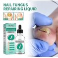 thumbnail image 4 of New Slinx Kerassentials Toenail Fungus Treatment Oil, Kerassentials For Toenail Fungus, 4 of 5