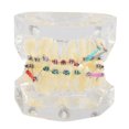 thumbnail image 3 of Modèle de Dent, Modèle Orthodontique, Modèle de Malocclusion Traitement Malocclusion pour l'Éducation Étudier Enseigner, 3 of 8