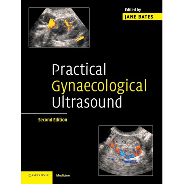 Ultrasons Gynécologiques Pratiques
