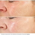 thumbnail image 2 of KLEEM ORGANICS Hydratant au Rétinol - Crème Anti-Rides pour Réduire les Rides, Taches Brunes et Dommages Causés par le Soleil - Idéal pour le Visage, le Cou et le Décolleté avec 2,5 % de Rétinol et Acide Hyaluronique - Meilleurs Résultats en 6 Semaines, 2 of 7