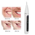 thumbnail image 4 of Scaler  Plaque Remover Teeth Stain Remover Intelligent  Electric  Scaler  Calculus Plaque Tartar Remover Cleaner, 4 of 8