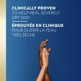 thumbnail image 3 of Vaseline Body Cream Problem Skin Therapy Unscented, 210 ml, 3 of 8