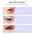 thumbnail image 4 of Rotatable Beauty Device Eye Massager Red Light Therapy Hot Compress Microcurrent Vibration Anti-aging Anti-Wrinkle Skin Tightening Magnetic Charging, 4 of 8