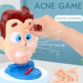 thumbnail image 4 of Tricky Spray Pimple Popping Game Parent Child Interactive Prank Toy Fun Party, 4 of 9