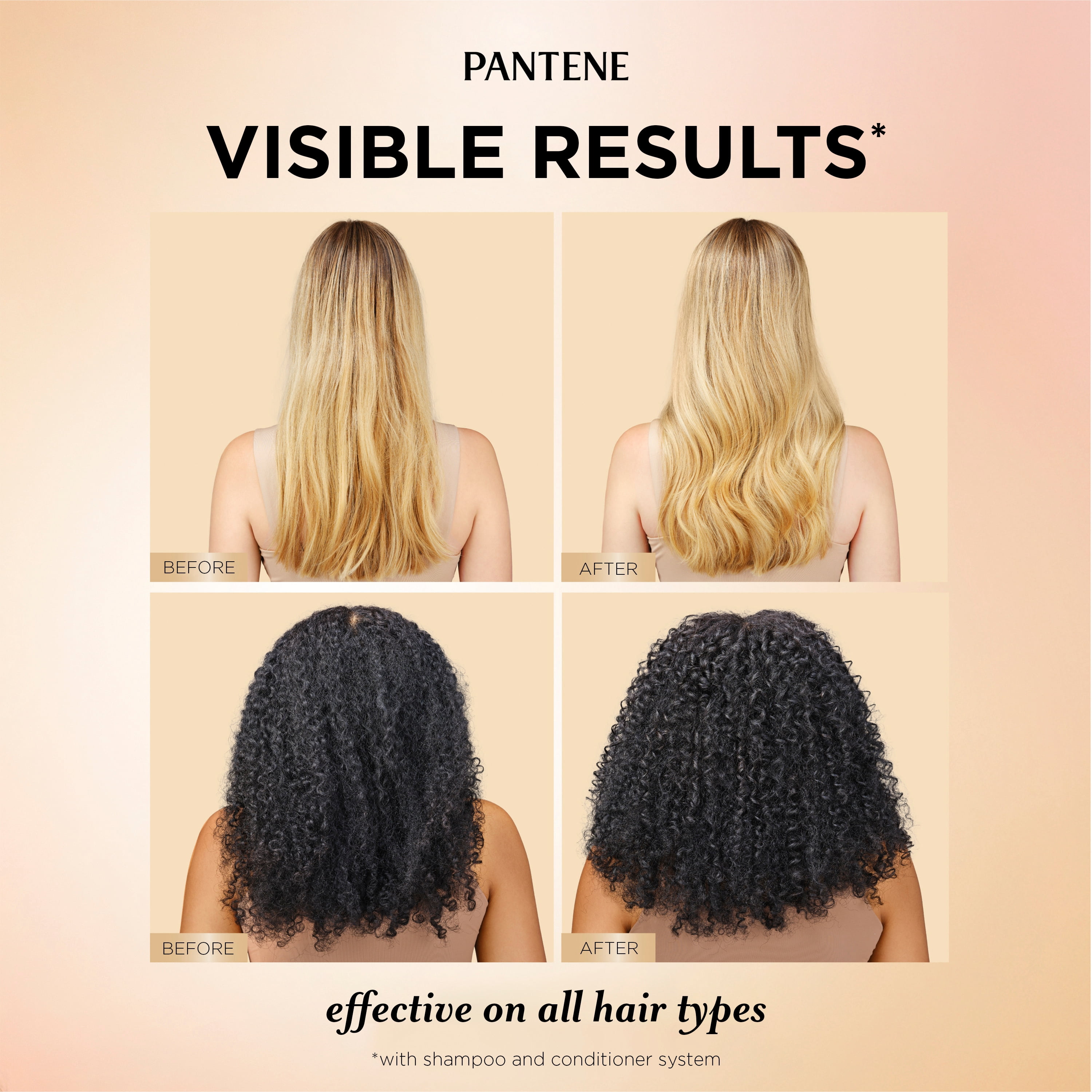 Revitalisant Pantene Pour Cheveux Abondants et Forts, Renforce Les Cheveux De La Racine À La Pointe, Complexe De Pro-Vitamine B5 et Antioxydants, 237 mL