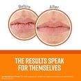 thumbnail image 5 of O'Keeffe's Unscented Lip Repair Lip Balm for Dry, Cracked Lips, Stick, 5 of 5