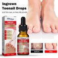 thumbnail image 3 of 10ml Ingrown Toenail Drops Fluid Soften Applying Ingrown Toenail Straightening Essential Oil Portable Nail Repairing Essence Accessory, 3 of 8