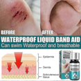 thumbnail image 2 of Medical Glue For Cuts, Fast-drying Breathable Liquid Skin Bandage, Great For Use On Fingers, 2 of 5