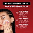 thumbnail image 3 of Thayers 2% SA Salicylic Acid Toner, 3 of 7