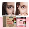 thumbnail image 1 of NARABB Rose Aloe Extract Gel Skin Firming Deeped Moisturising After Sun Repair 100 G, 1 of 9