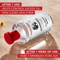 thumbnail image 2 of Thayers Original Face Astringent with Witch Hazel and Aloe Vera formula, 2 of 8