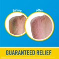 thumbnail image 2 of Okeeffes Healthy Feet Intense Renewal Cream, 3 Oz Tube, 1-Pack, 2 of 5
