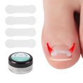 thumbnail image 1 of 10Pcs/Box Nail Correction Sticker Comfortable Cozy Quick Stick Fashionable Effective Health Care Tool Resin Impacted Toenail Correction Paste for Home, 1 of 8