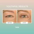 thumbnail image 3 of Contours Rx Lids By Design - Non-Surgical, Invisible & Instant Eyelid Lift Strips - For a More Youthful-Looking Appearance, Reshape and Define with Eyelid Tape for Hooded Eyes (7mm) 80ct, 3 of 8