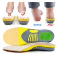 thumbnail image 4 of 1 Pair Orthopedic Flat Foot Sole Pad Orthotic Insoles for Sports Light Large, 4 of 8