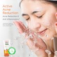thumbnail image 3 of VLCC Clarifying Face Wash, Face Cleanser with Turmeric, 100 ml, 3 of 9