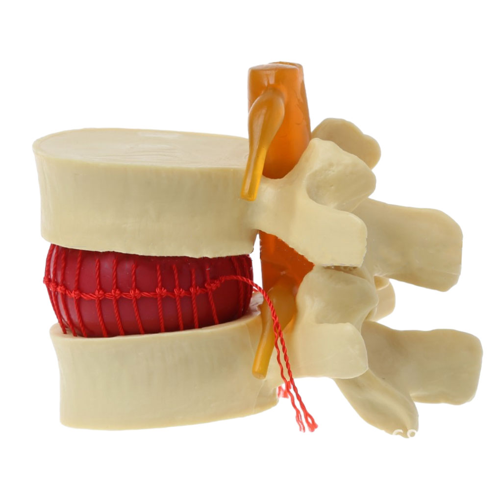 tredstone Modèle d'Anatomie Facile à Lombaire Enseignement et Formation Compact et Facile à Transporter Jaune 1Set