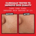 thumbnail image 3 of Thayers Unscented Facial Toner Witch Hazel Aloe Vera Formula, 355 mL, 3 of 10