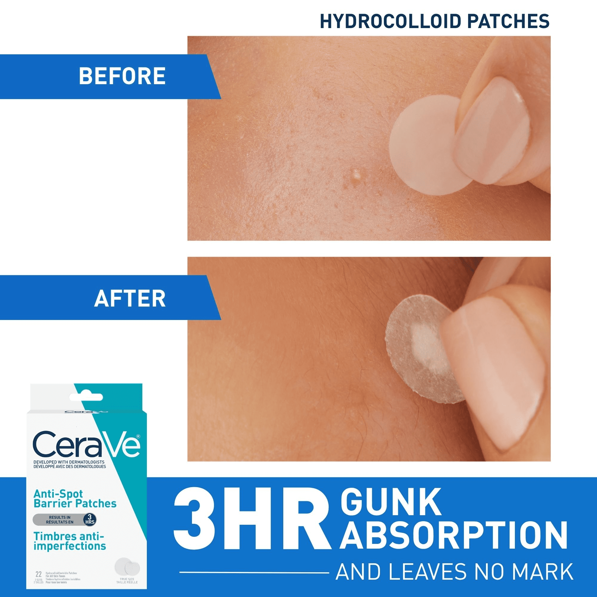 CeraVe Timbres Anti-Spot Barrière, Pansements Hydrocolloïdes Invisibles avec Céramides et Niacinamide