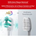 thumbnail image 2 of Brosse à dents sonique à piles Colgate Total, poils souples, 2 of 7