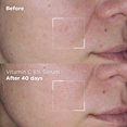 thumbnail image 4 of Sérum vitamine C 6 %, 4 of 8
