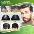 thumbnail image 2 of Hair Growth Shampoo Conditioner 220ml Anti Hair Loss Repair Herbal Ginger, 2 of 9