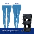 thumbnail image 3 of Corrective Leg Bandage Foot Care Tools O Form X Form Legs Correction Belt Correction Band, 3 of 8