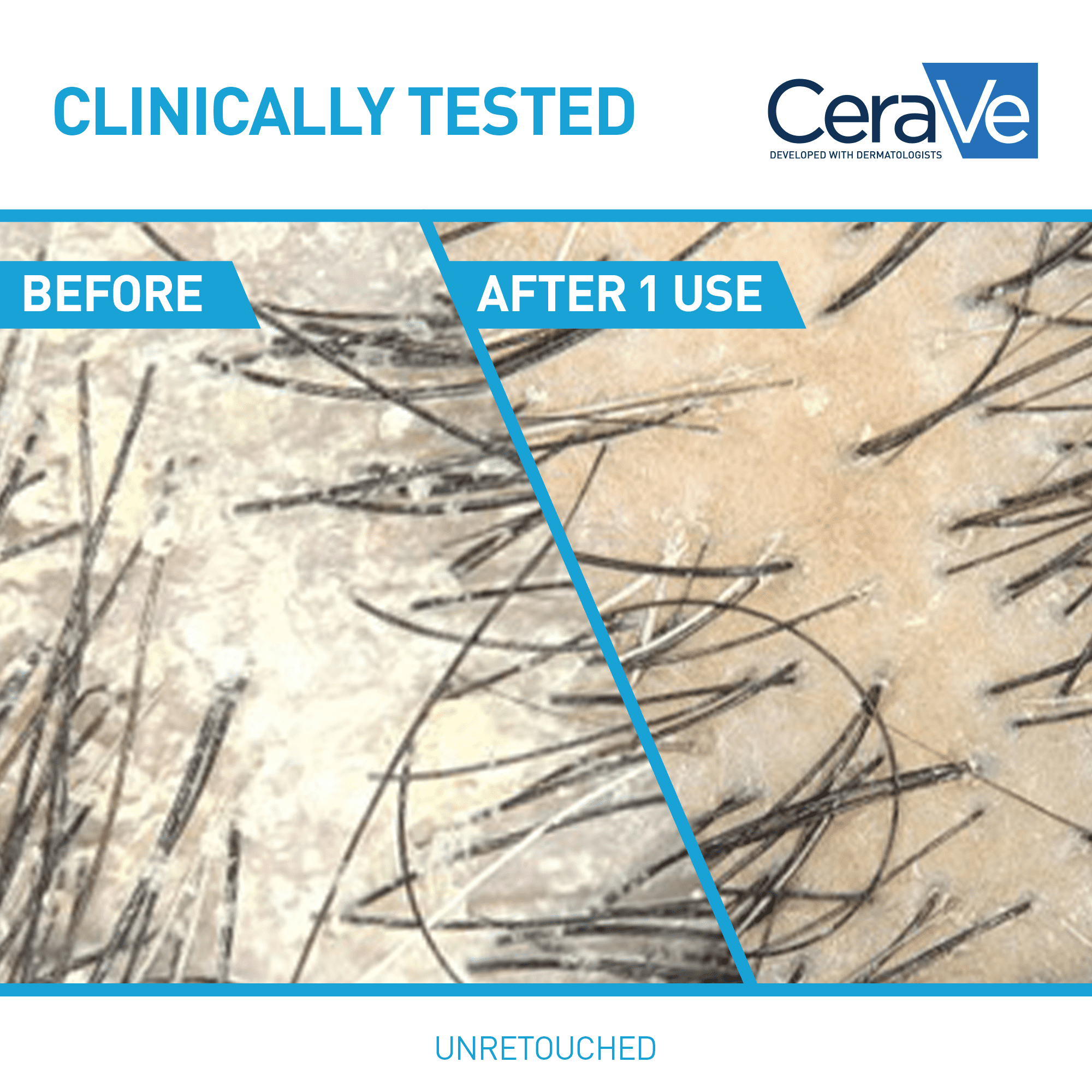 CeraVe Anti-Dandruff Hydrating Conditioner, Clinically Tested Conditioner with 0.5% Pyrithione Zinc, 266mL