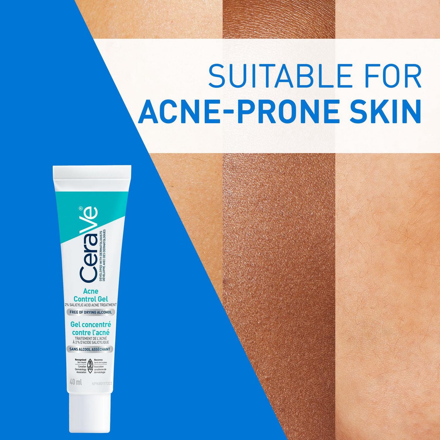 CeraVe Gel Contrôle de l'Acné, Traitement avec 2 % d'Acide Salicylique et AHA pour Visage, 40 ml
