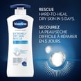 thumbnail image 4 of Vaseline Lotion Extremely Dry Skin Rescue Fragrance Free, 600 ml, 4 of 6