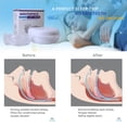 thumbnail image 4 of Snoring Adjustable Anti Grinding Braces Anti Grinding Teeth Device for Night Time Sleep, 4 of 7