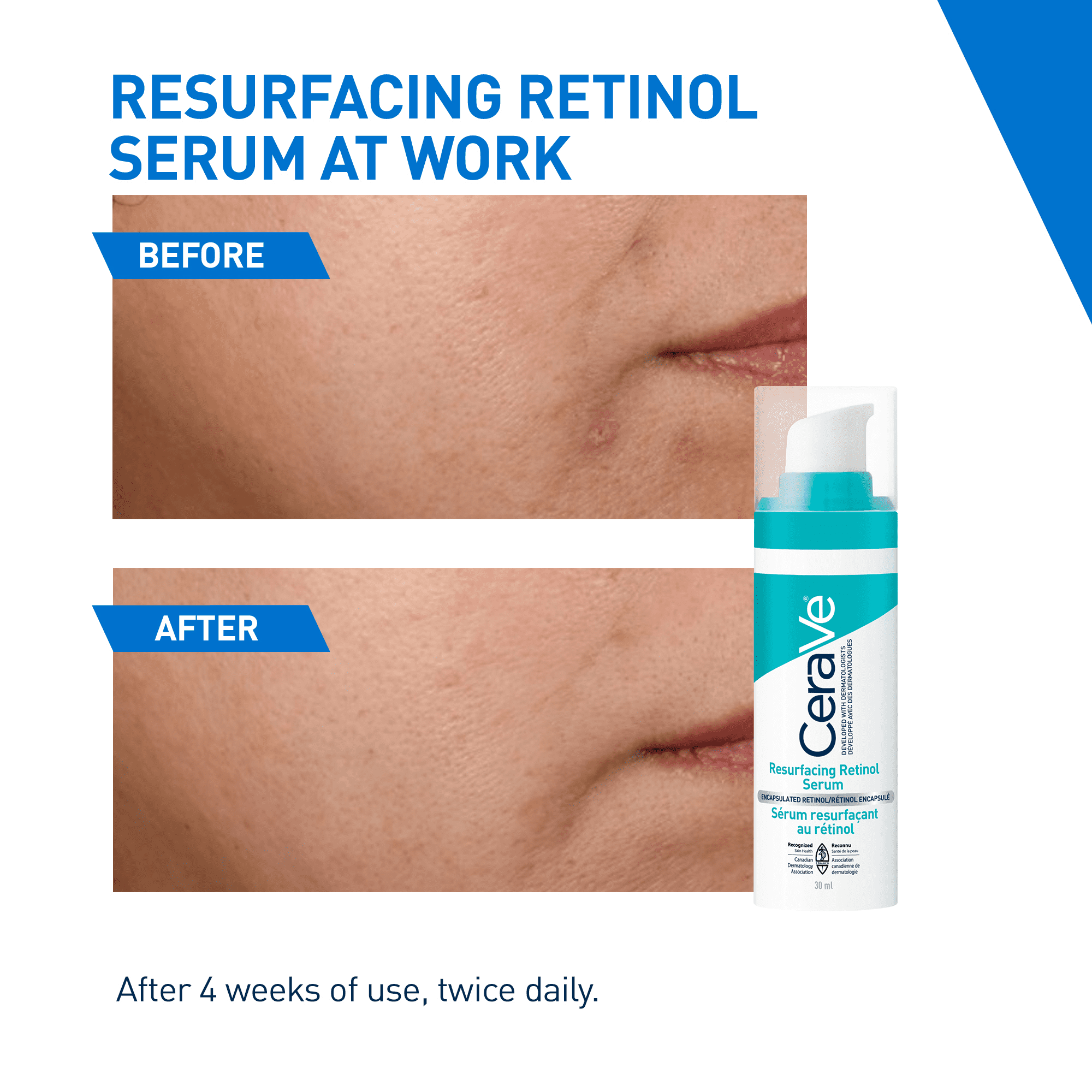 CeraVe Sérum Rénovateur au Rétinol, Sérum Visage avec Rétinol Encapsulé pour Marques Post-Acné, 30 ml