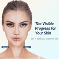 thumbnail image 2 of TUMAKOU RF Radio Frequency Facial Machine Skin Care Anti Aging Rejuvenation Device Body Face Skin Tightening Professional At-Home Anti Wrinkles Skin Lifting, 2 of 7