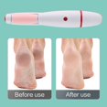thumbnail image 3 of Electric Foot File Callus Remover Heels Grinding Pedicure Machine (Pink), 3 of 7
