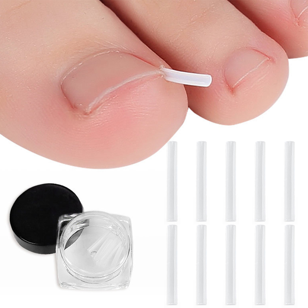 10 Pcs Correcteur d'Ongle Incarné Professionnel avec Boîte