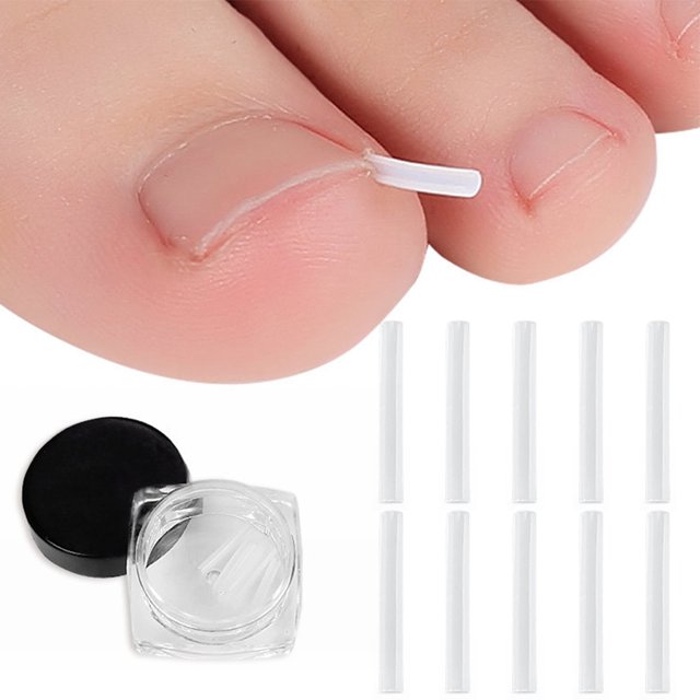 10 Pcs Correcteur d'Ongle Incarné Professionnel avec Boîte