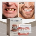 thumbnail image 3 of Advanced Full Set of Dentures, Silicone Reline Denture HOT Soft Set, 3 of 8
