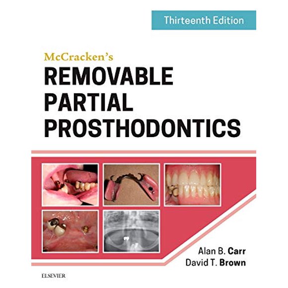 Prosthodontiques Partielles Amovibles de McCracken