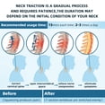 thumbnail image 3 of Cervical Neck Traction Device, Adjustable Cervical Traction Device with 3 Power Tractions and 8 Built-in Airbag Support, Neck Pain Relief and Relaxation, 3 of 7