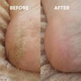 thumbnail image 4 of RKSTN Foots File Foot File Glass Foot File Callus Remover Glass Foot File For Heel Shower Foot Dead Skin Remover, 4 of 8