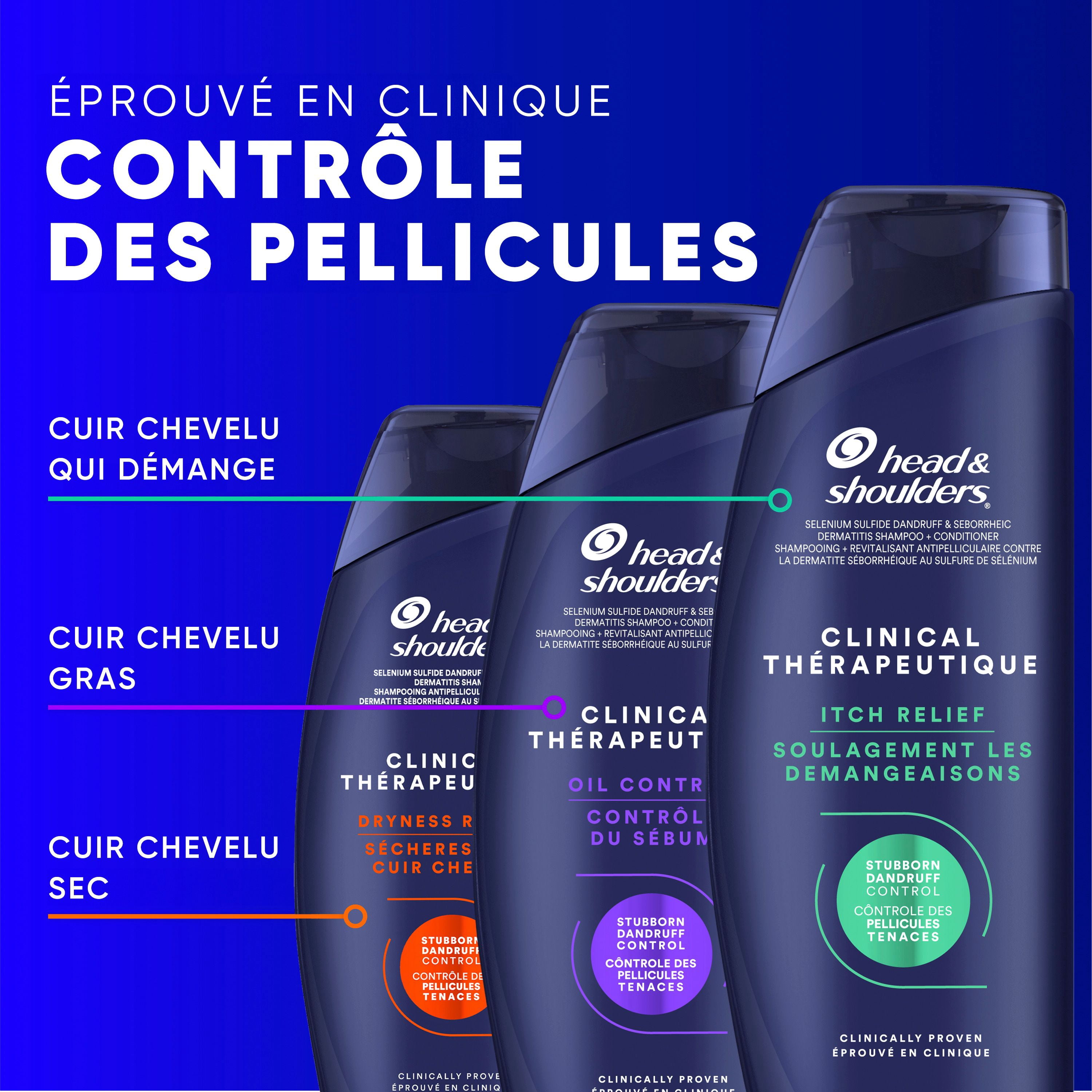 Head & Shoulders Clinical Dryness Rescue 2in1, for Stubborn Dandruff