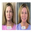 thumbnail image 5 of Crème de Soin pour la Peau LifeCell 75 ml Garde le Visage Hydraté et Répare la Peau Abîmée, 5 of 5
