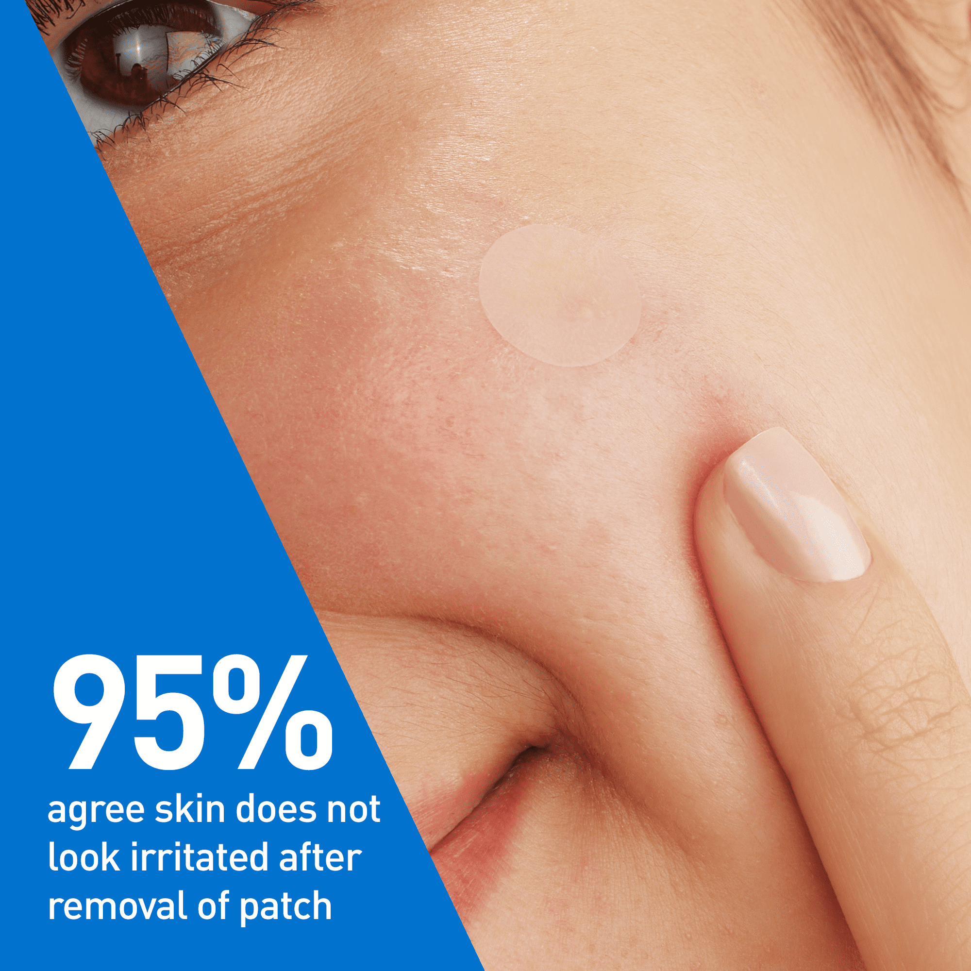 CeraVe Timbres Anti-Spot Barrière, Pansements Hydrocolloïdes Invisibles avec Céramides et Niacinamide