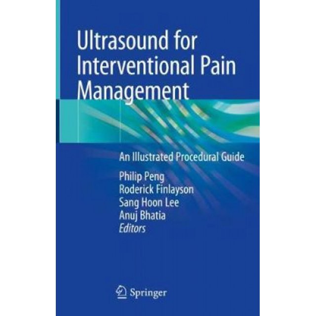 Ultrasound pour Gestion de la Douleur par Intervention : Guide de Procédure Illustré
