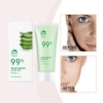 thumbnail image 4 of Fresh Aloe Vera Gel for Face & Body - 100g Hydrating, Soothing Gel for Sunburn Relief & Moisturizing - Cool, Refreshing Formula for All Skin Types, 4 of 9